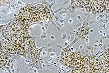 Cultured fetal hepatocytes display heterogeneous pattern