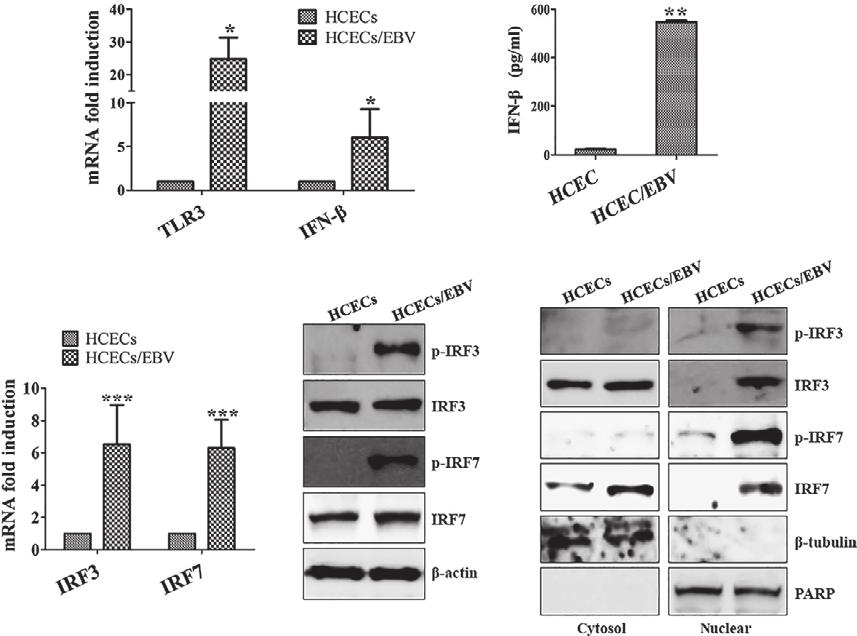 J. Cell. Mol. Med. Vol 19, No 5, 2015 A B C D E Fig. 3 EBV produces IFN-b through enhanced phosphorylation and nuclear accumulation of IRF3/IRF7 in HCECs.