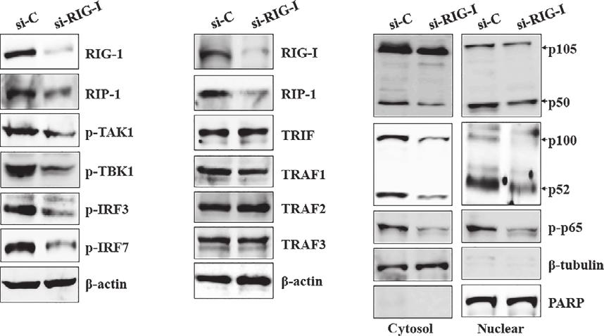 J. Cell. Mol. Med. Vol 19, No 5, 2015 A B C Fig. 5 RIG-1 mainly regulates activation of TAK1/TBK1/IRFs pathway in HCECs/EBV.