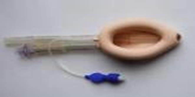 Laryngeal Mask Airway (LMA) The LMA provides a more secure and reliable means of ventilation than