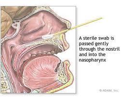 MRSA Nasal Specimen Collection Use the special MRSA swab; insert ¾ inch into nose Culture both anterior
