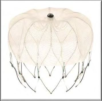 The WATCHMAN product is a device for percutaneous closure of the left atrial appendage WATCHMAN is a self-expanding nitinol
