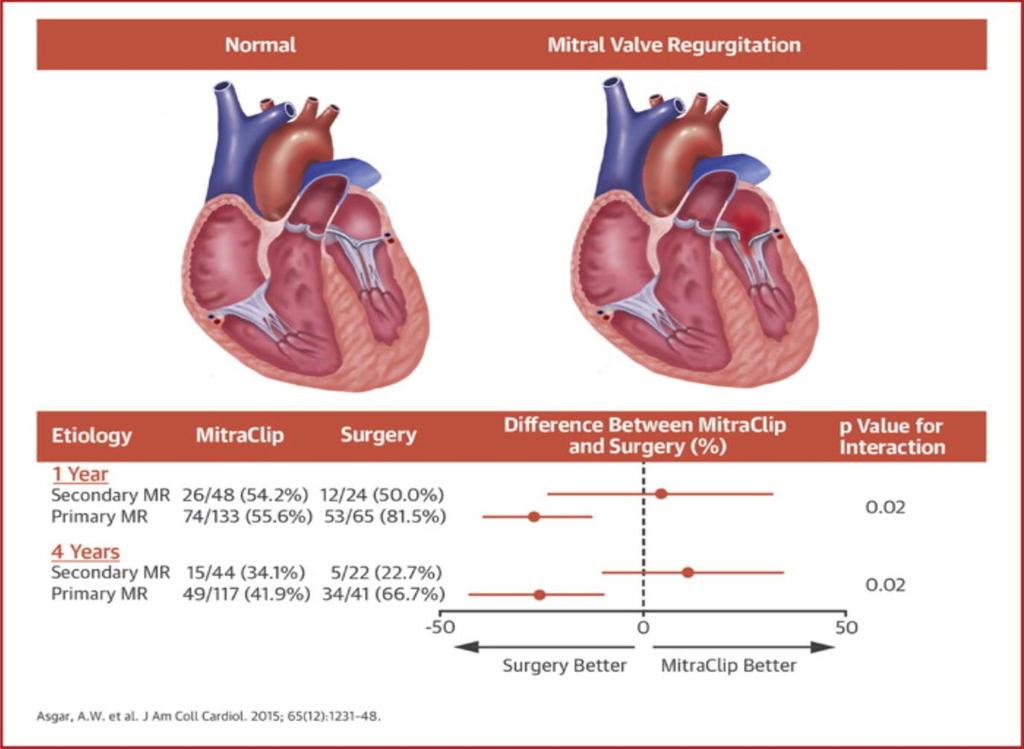 From: Secondary Mitral Regurgitation in Heart Failure: Pathophysiology, Prognosis, and Therapeutic Considerations Secondary MR in Heart Failure: Interaction Between the Etiology of MR and the
