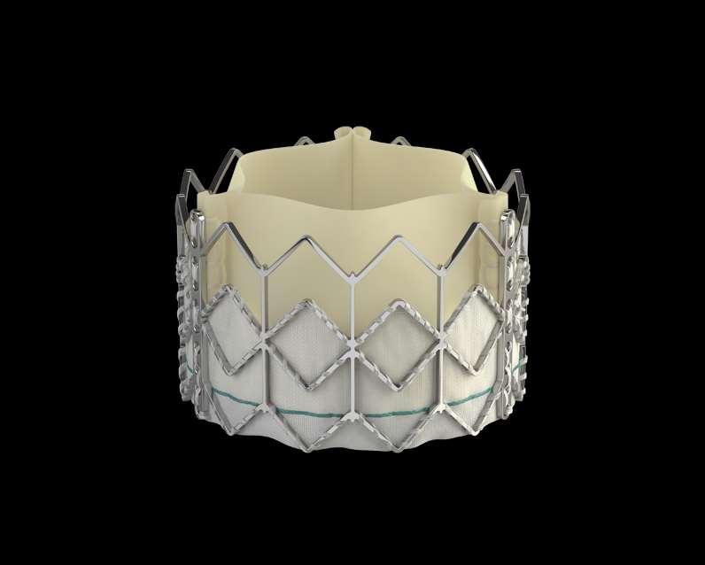 Edwards SAPIEN Transcatheter Heart Valve The Edwards SAPIEN transcatheter heart valve is indicated for patients with severe symptomatic calcified native aortic valve stenosis who