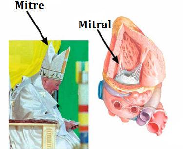 can coexist Single disease process Different disease processes One valve lesion may cause another Certain combinations are particularly burdensome (AS & MR) Mitral Valve