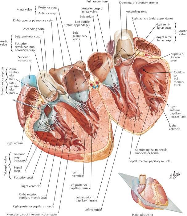 Acute Mitral Regurgitation Infective endocarditis Ischemic Heart disease Papillary