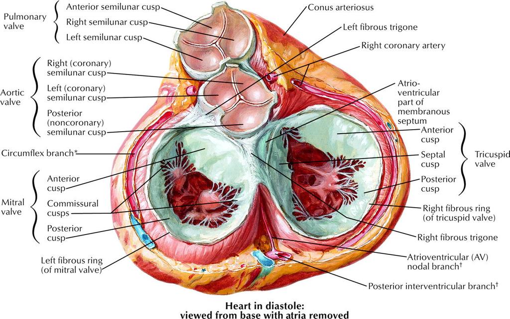 Regurgitation Ischemic Heart disease Papillary msdysfunction Inferior & posterior MI