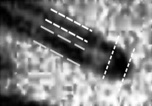 The capillary images are obtained from a USB digital microscope. Gaussian filter followed by Otsu s method of thresholding is used for removal of noise, background and image enhancement.