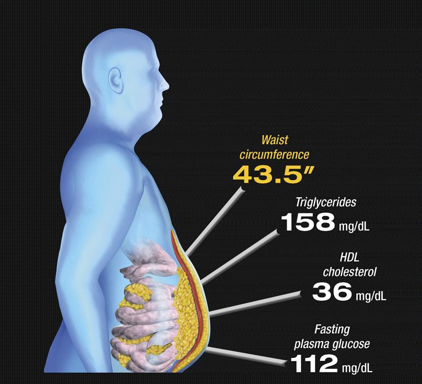 RFs in abdominal obesity (104 cm) (1.8 mmol/l) (0.