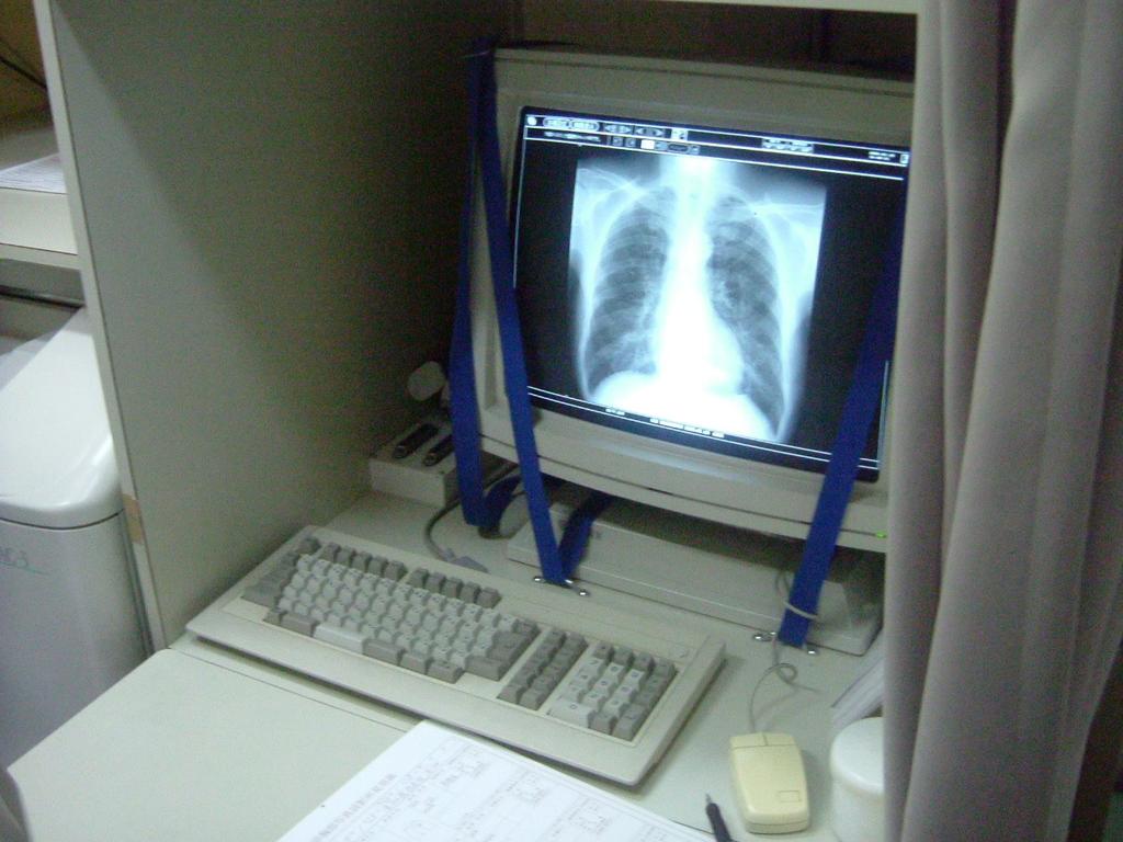 Digital Chest-Xray Immediate result without film processor/water No stock space for films Easy data