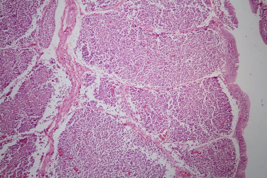 Tumor diagnosis in breeders and layers Histopathology Skin lesions with 1 cm margin Nerves from each chicken, Vagus,
