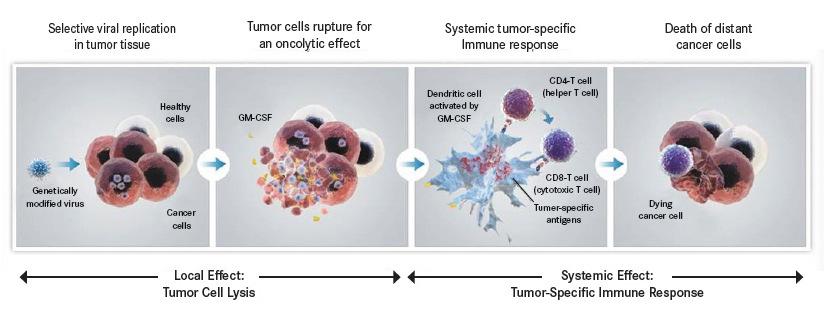 Classes of Immunotherapy: Oncolytic Viruses Viral vector (HSV1) Replicate and lyse injected tumor Manipulate genome to enhance effect: -suppressive genes; + GM-CSF Example: T-VEC Metastatic Melanoma