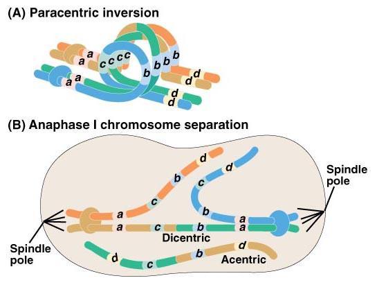 Inversions Paracentric inversion Centromere not part of inversion loop Results in Normal chromosome Dicentric