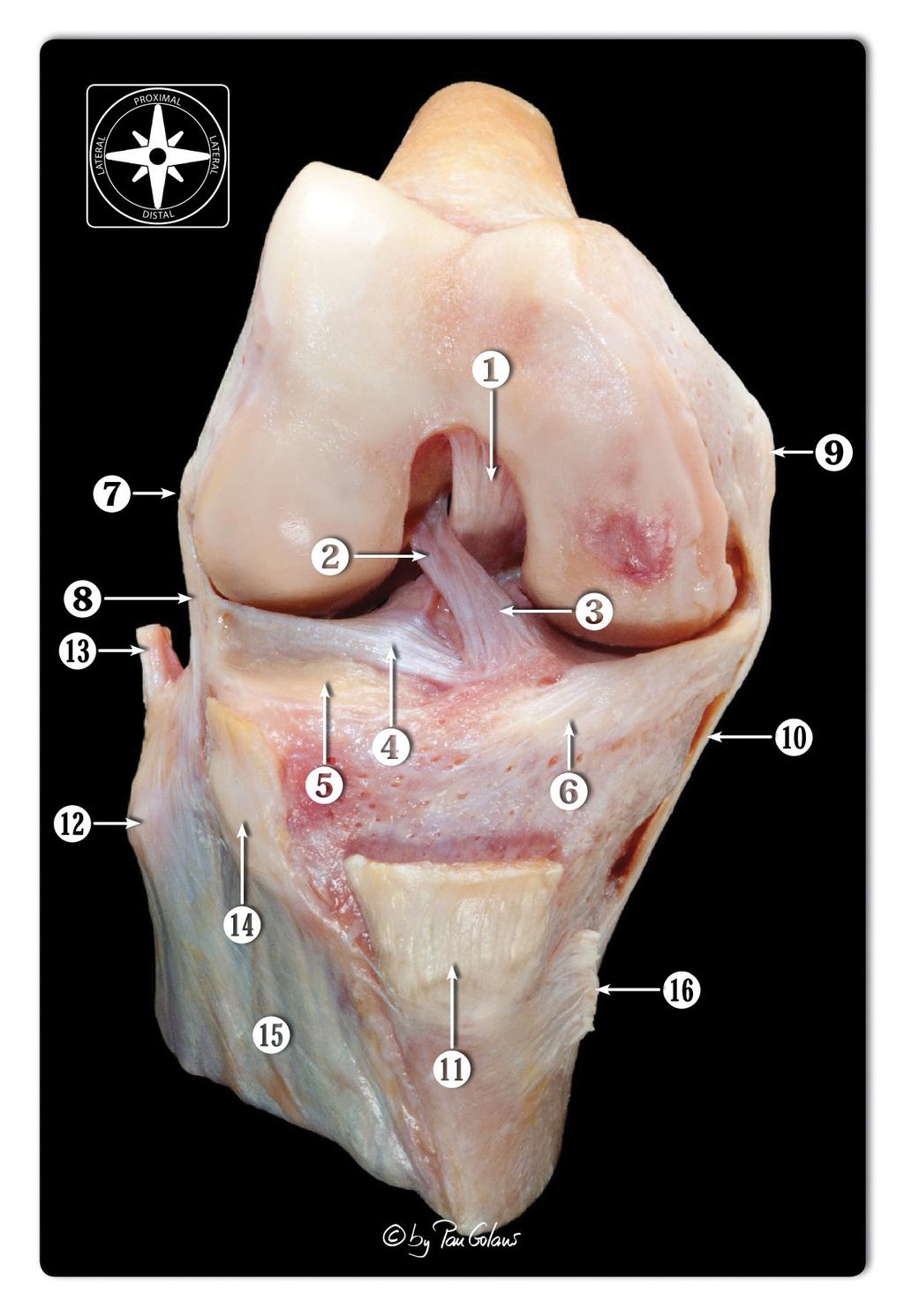 Figure 1: Anterior view of the osteoarticular dissection of the right knee joint. Knee in 90º of flexion.