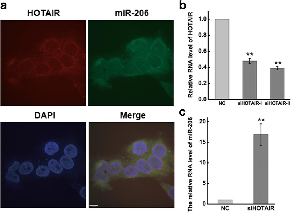 Zheng et al. Cell Communication and Signaling (2018) 16:5 Page 10 of 15 Fig. 7 Detect the localization of HOTAIR and mir-206 by RNA FISH in HeLa cells.
