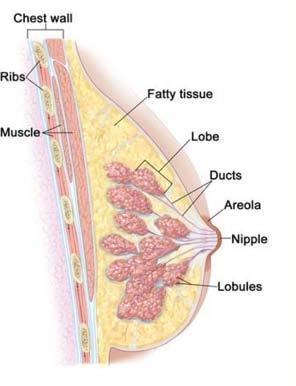 originates in ducts or lobes Axillary nodes