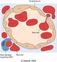 Figure 11 2 Sickle cell