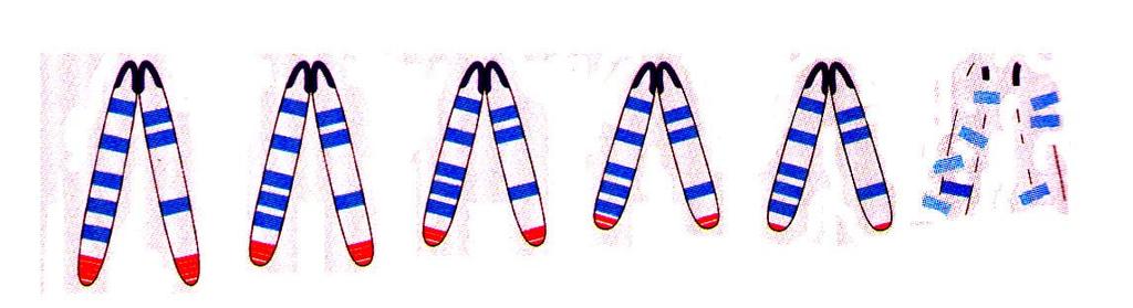 Telomere shortening Telomeres are sequences of nucleic acids extending from the ends of chromosomes.
