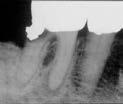 * These images were published in The Color Atlas of Endodontics, Dr. William T. Johnson, p.