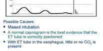 Esophageal Intubation False positive with qualitative Must interpret the