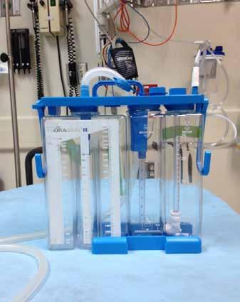 Chest Tube Placement Current Thora-Seal set up: Put sterile water in suction chamber to ordered cm h2o by physician Fill water seal chamber to line with sterile