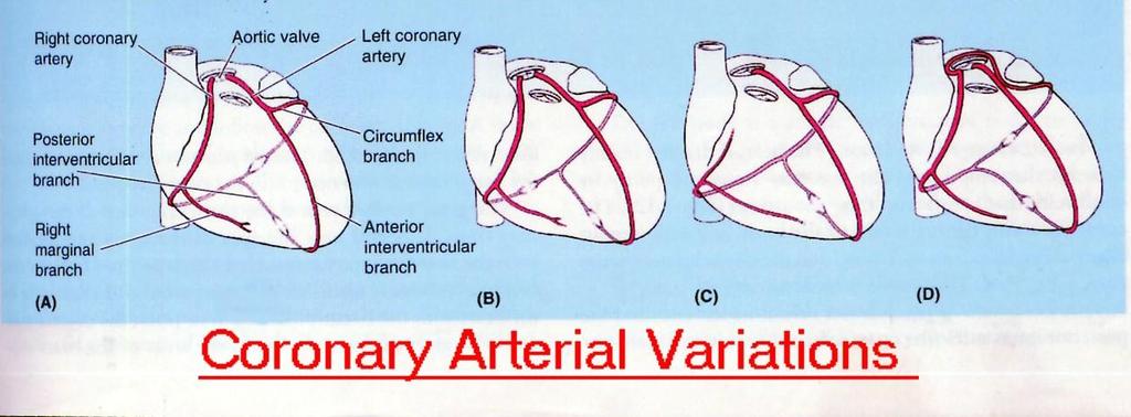 5 NB: C in the diagram is an unusual case of a single coronary artery arising from the left aortic sinus.