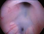 Main features of the course Lectures on endoscopic anatomy, endoscopic equipment,