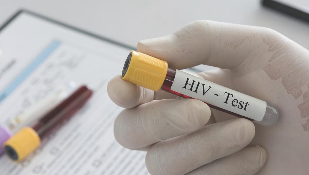 CDC recommends HIV screening for all persons who seek evaluation and treatment of STIs (21).