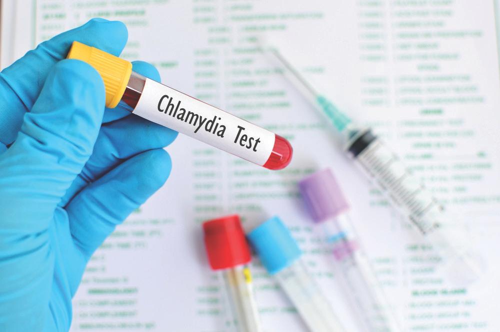 Health of Boston 2016-2017 Among females, the incidence rate for chlamydia was 3.2, 3.4, and 2.0 times higher respectively, for females ages 13-19 (1,590.