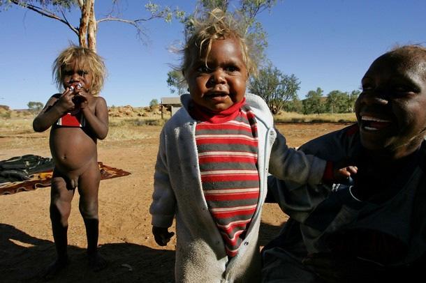 Where & how do stone-forming Aboriginal Australian children live?