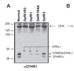 Anti Factor H antibodies : genetic background In association with CFHR1 deficiency in 85% (2 to 10% in heathly controls) Screening strategy : Multiplex ligation dependant amplification and western