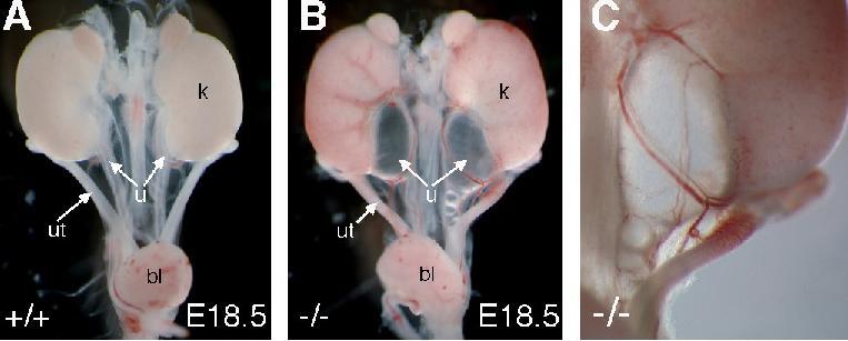 Congenital Hydronephrosis in Teashirt-3 Homozygous Null Mutant Mice (Phenotype Apparent from
