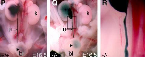 There is no Anatomical Block to Urine Flow in Tshz3 Mutant Mice