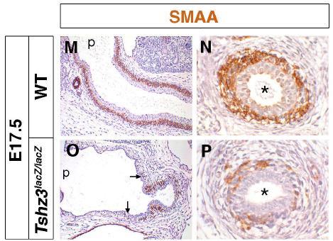 In Late Gestation, Proximal Ureters of Tshz3 Mutants Lack Smooth Muscle