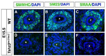 Failure to Initiate Expression of Smooth Muscle Contractile Proteins In thetshz3