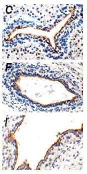Uroplakin III Protein Expression in the Human Fetus Uroplakin in brown Nuclei in blue Seven week bladder