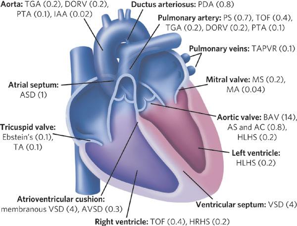 Cyanotic Congenital Heart Disease 24 This diagram of the adult heart illustrates the structures that are affected by congenital heart diseases, with the estimated incidence of each disease per 1,000