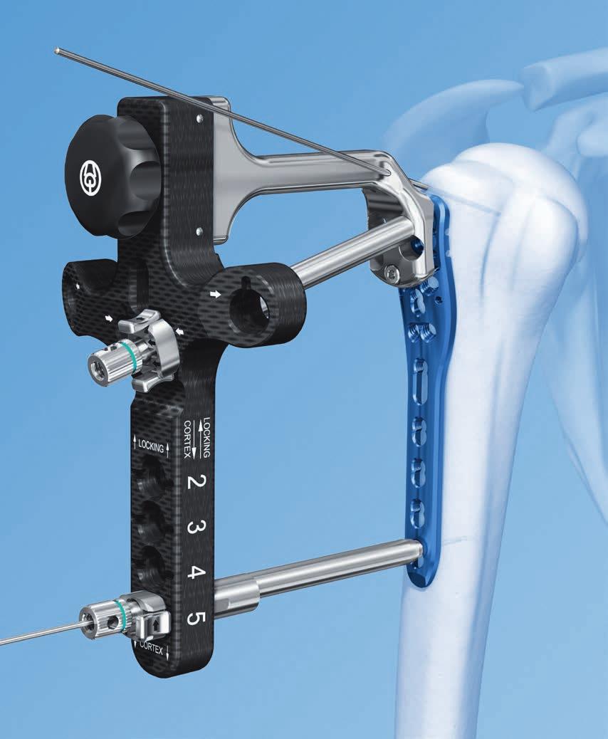 LCP Percutaneous Aiming System 3.5 for PHILOS. For less invasive surgery at the proximal humerus.