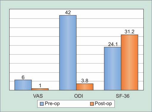 Percutaneous Posterior Fixation: A Unique Entity to minimize Further Damage to Patient with Traumatic Spine was 31.2 in those operated by percutaneous method (Table 3 and Graph 1).