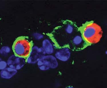 Tumor-Associated Macrophages Macrophages in