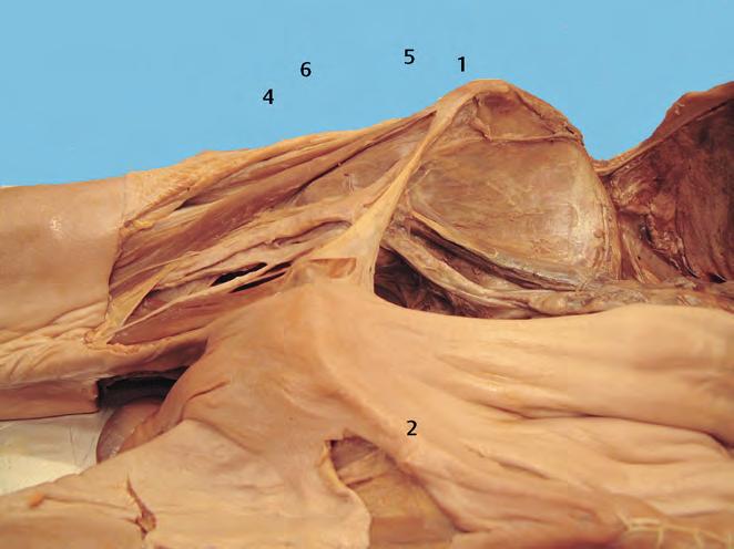 The classically described puncture site is 1 cm below the inguinal ligament and ca. 1.5 cm lateral to the femoral artery (note: IVAN = Inside Vein, Artery, Nerve) (Figs. 9.7, 9.8).