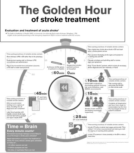 Acute Stroke Treatment IV rt-pa IA