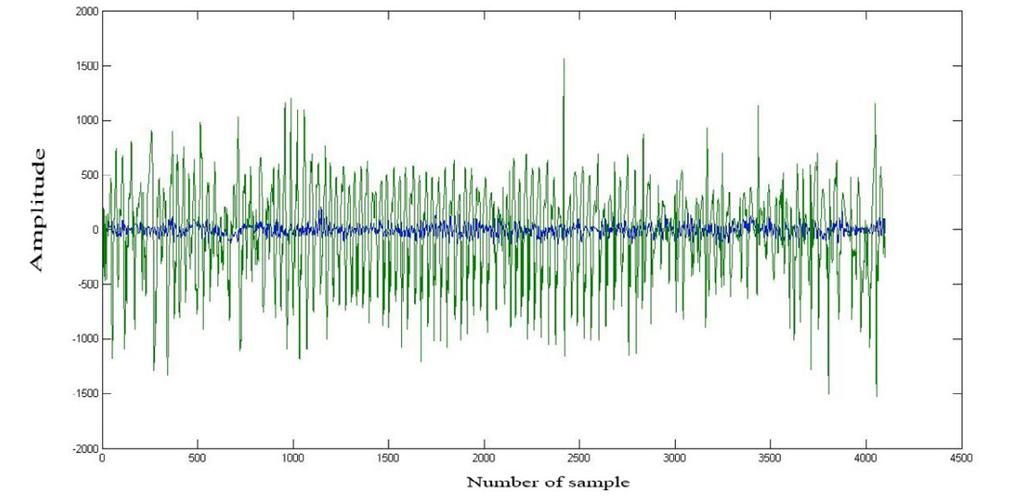 In a wide-spreading spectrum, recorded EEG signals may contain technical and physiological noises [3].