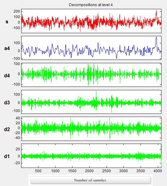 Compared to EEG signals, sub-bands have more accurate information about neurons activities. They may not be evident in the original signals due to specific changes.