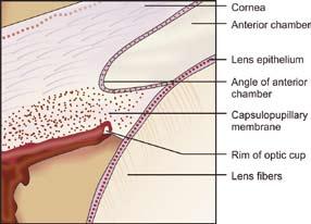 6 眼科学 Ophthalmology layers in the seventh week of gestation. The ganglion cells, Müller s cells and amacrine cells are derived from the inner neuroblastic layer.