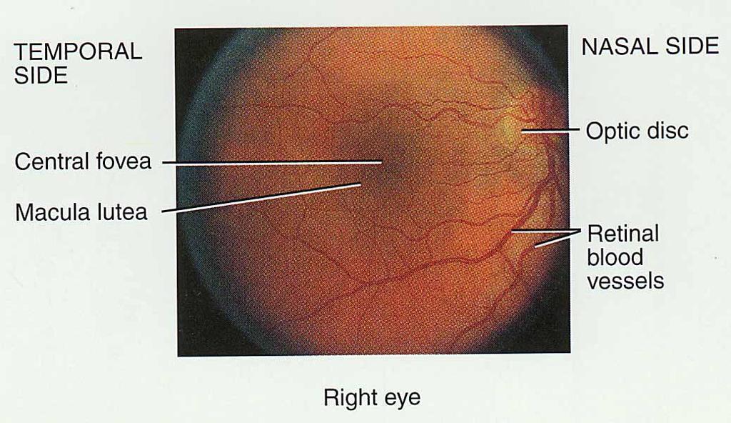 Nervous Tunic -- Retina View with Ophthalmoscope Posterior 3/4 of eyeball Optic disc optic nerve exiting back of eyeball Central retina BV fan out to