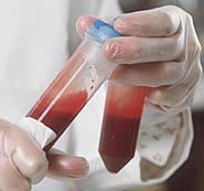 Materials covered under the OSHA Standard BLOOD: Human Blood Blood Products Blood Components OTHER POTENTIALLY INFECTIOUS MATERIALS (OPIM): Unfixed human tissue or