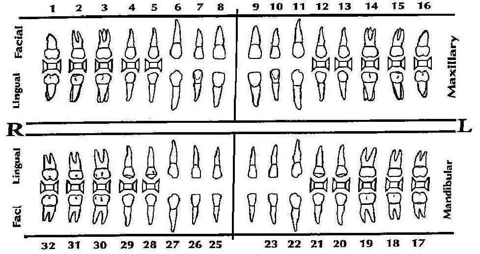 Dental Charting Paper Chart Black s Classification I VI