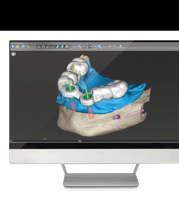 codiagnostix codiagnostix - DIGITIZE YOUR WORKFLOW AND TAKE ADVANTAGE OF EXCITING OPPORTUNITIES codiagnostix is the dental implant planning software for dental clinicians and laboratories.