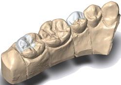 DWOS DWOS A COMPREHENSIVE PROSTHETICS DESIGN SUITE DWOS covers a complete range of dental